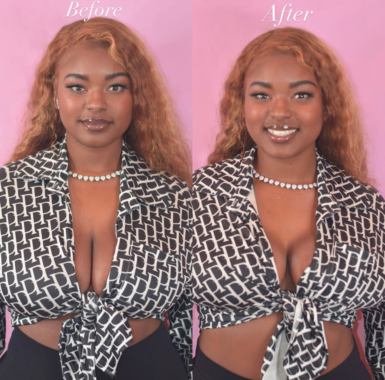 Assets Boob Tape - Brown